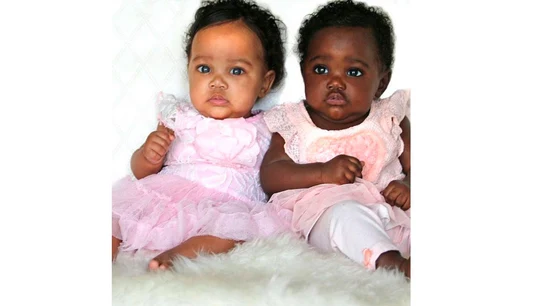 Foto de las gemelas con tonos de piel distintos Foto de las gemelas con tonos de piel distintos