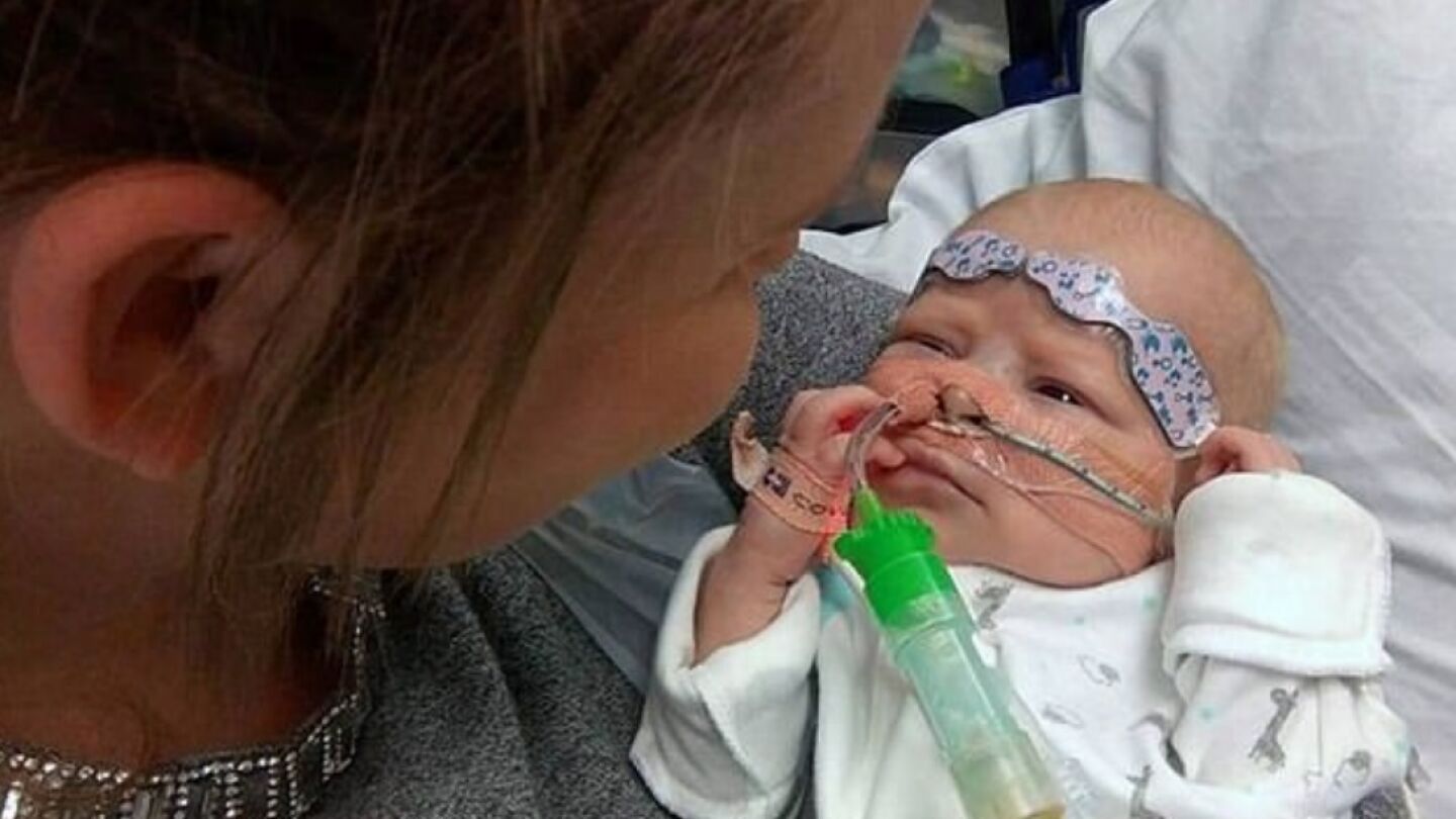Beb&eacute; de ocho semanas que ha superado con &eacute;xito un trasplante de coraz&oacute;n