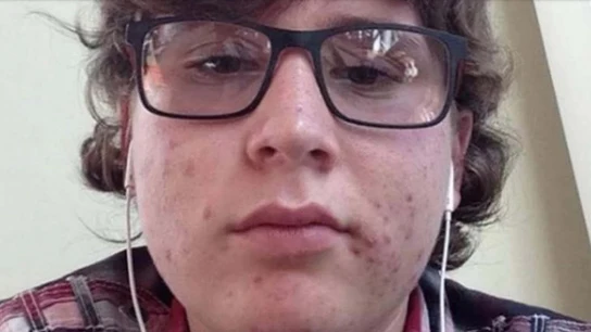 Imagen del joven agresor sexual tn.com.ar