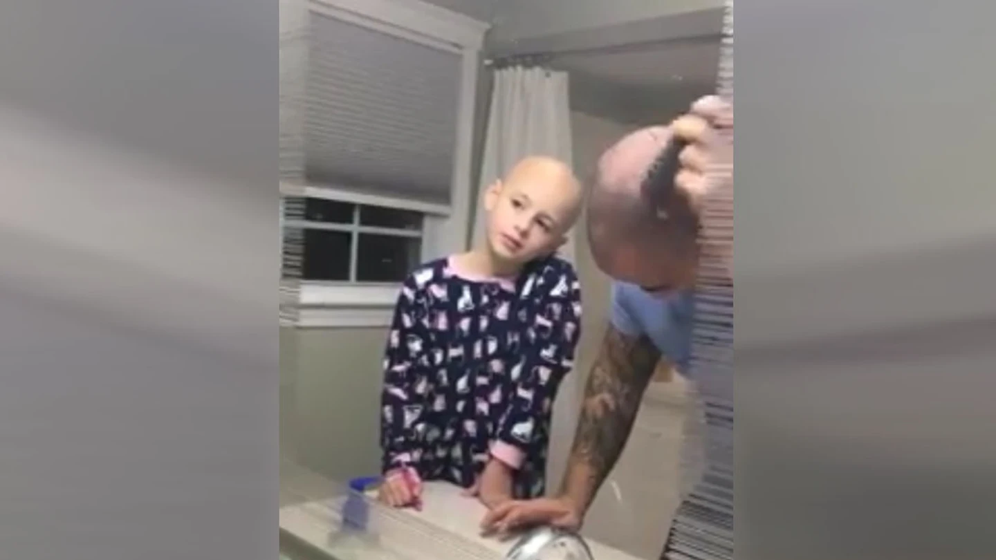 Un padre se rapa para solidarizarse con su hija con alopecia Un padre se rapa para solidarizarse con su hija con alopecia