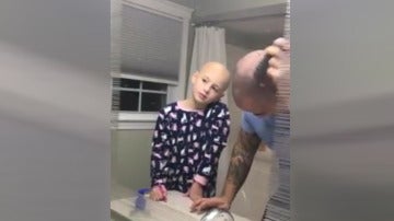 Un padre se rapa para solidarizarse con su hija con alopecia