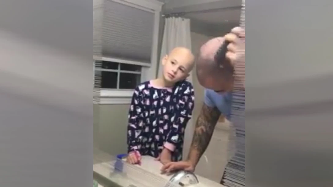 Un padre se rapa para solidarizarse con su hija con alopecia