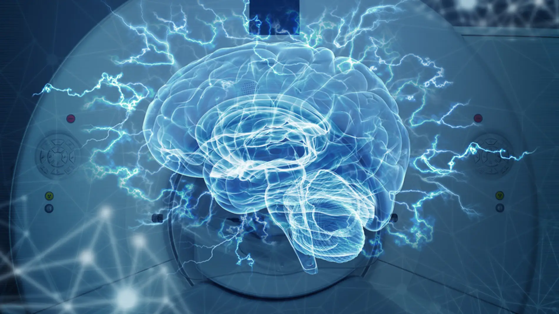 Imagenes del cerebro refutan