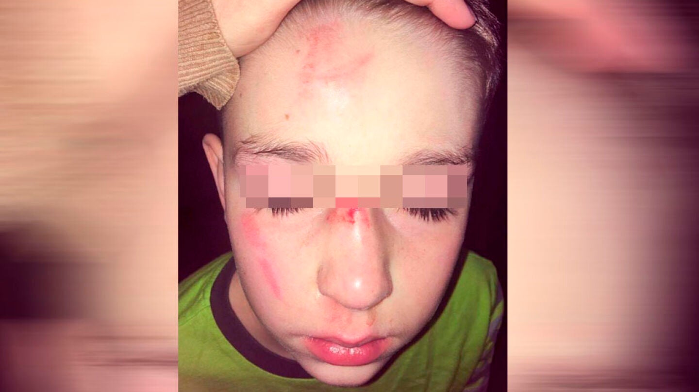 Imagen de un meno tras ser agredido por sus compa&ntilde;eros