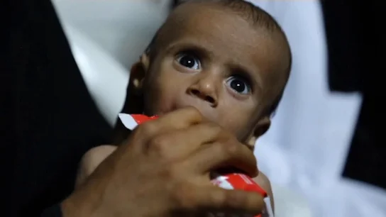 Víctimas al borde de la hambruna tras 1.000 días de guerra en Yemen Víctimas al borde de la hambruna tras 1.000 días de guerra en Yemen