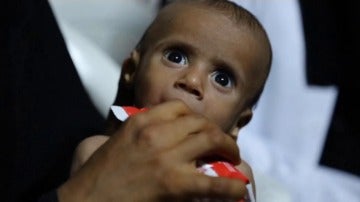 Víctimas al borde de la hambruna tras 1.000 días de guerra en Yemen