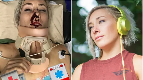 Caroline Buchanan, ciclista de BMX, tras su grave accidente Caroline Buchanan, ciclista de BMX, tras su grave accidente