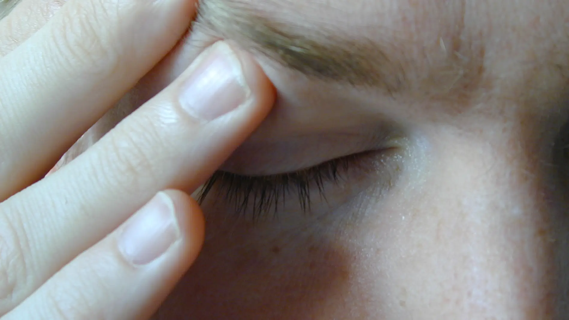 Paciente con migraña. Fuente: Morguefile.