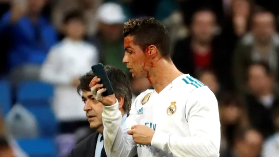 Cristiano Ronaldo, con un móvil para verse una herida Cristiano Ronaldo, con un móvil para verse una herida