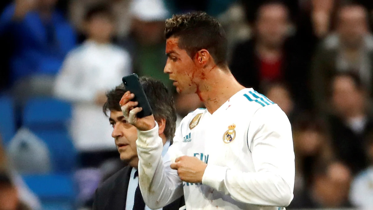 Cristiano Ronaldo, con un móvil para verse una herida