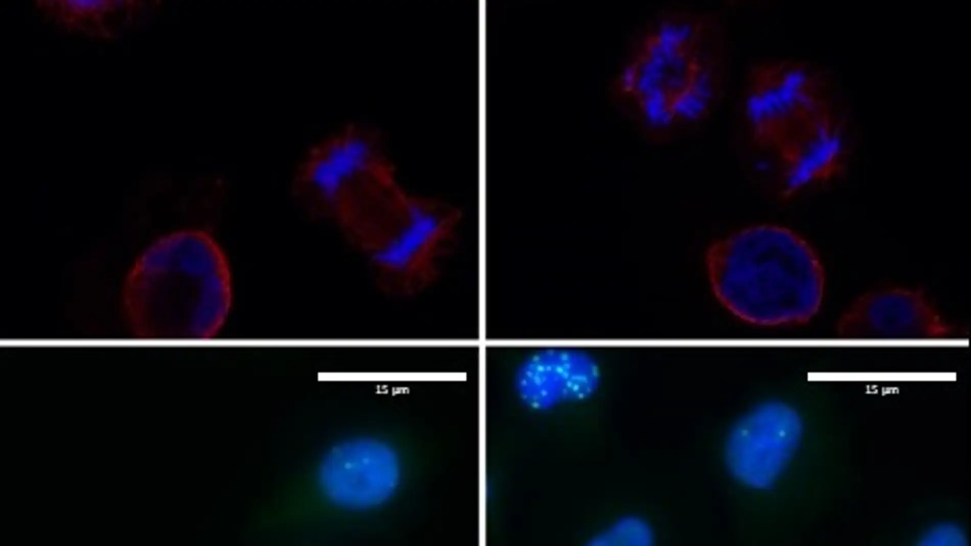 Las células del melanoma son adictas a la proteína LOXL3