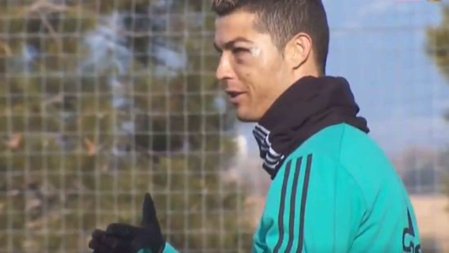Cristiano reparece con un bulto en el ojo