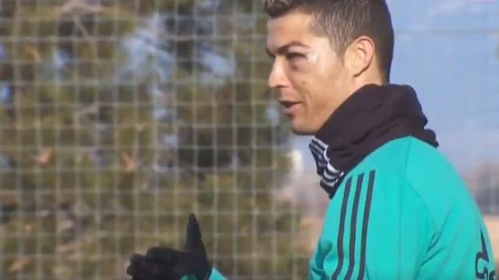 Cristiano reparece con un bulto en el ojo