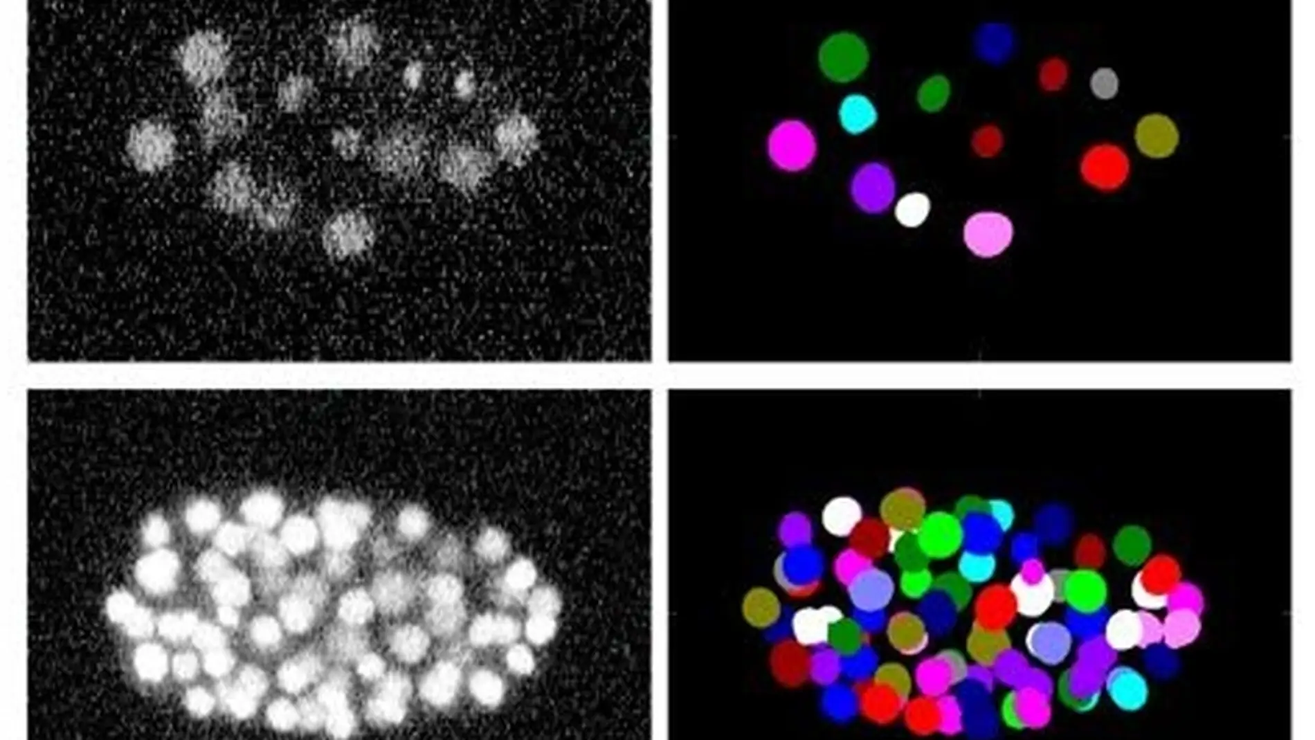 Imágenes de microscopía de un gusano