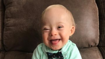 Lucas, el primer bebé con síndrome Down que es imagen de la marca Gerber