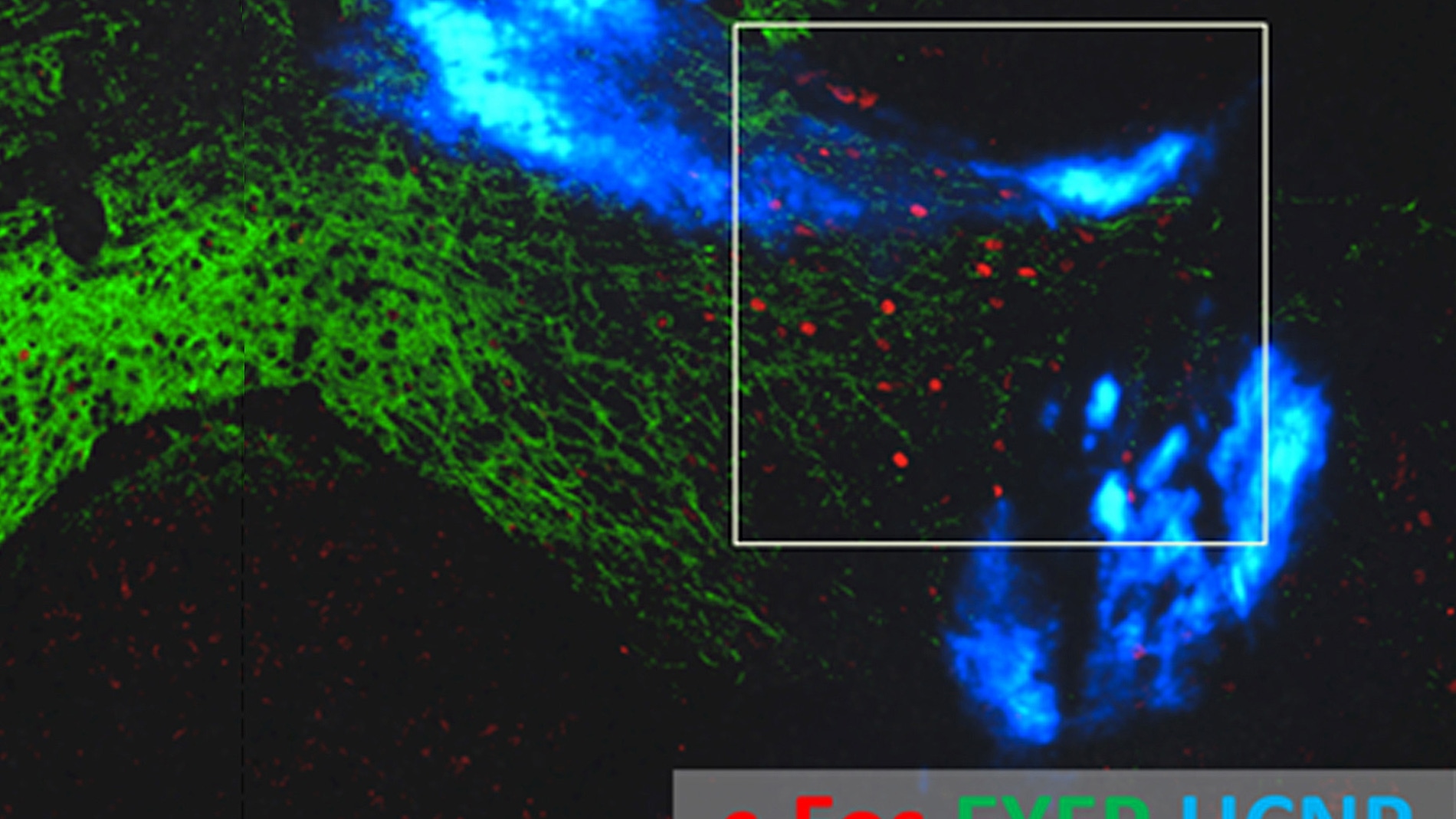 Luz y nanoparticulas para estimular las profundidades del cerebro