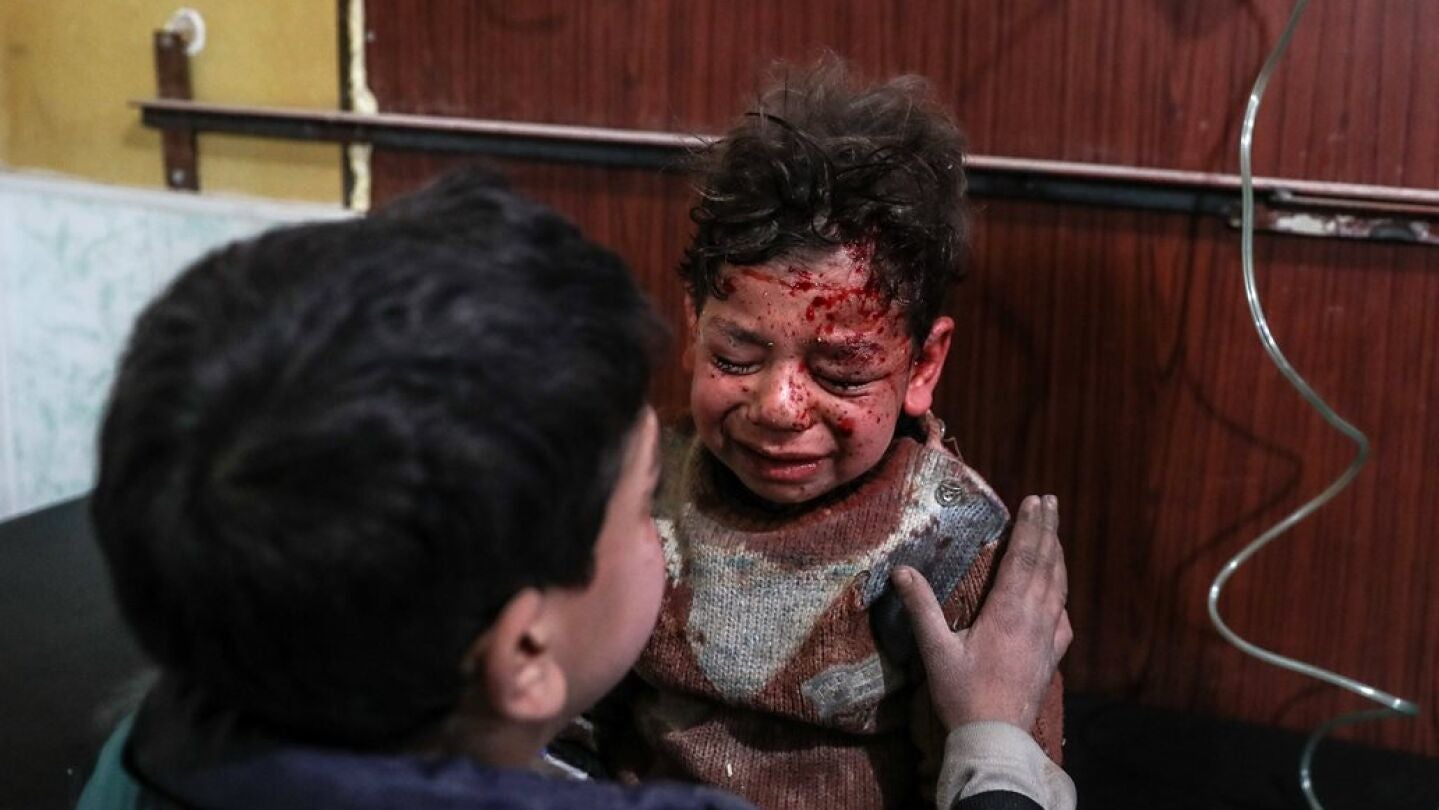 Dos ni&ntilde;os heridos en los ataques de Guta Oriental