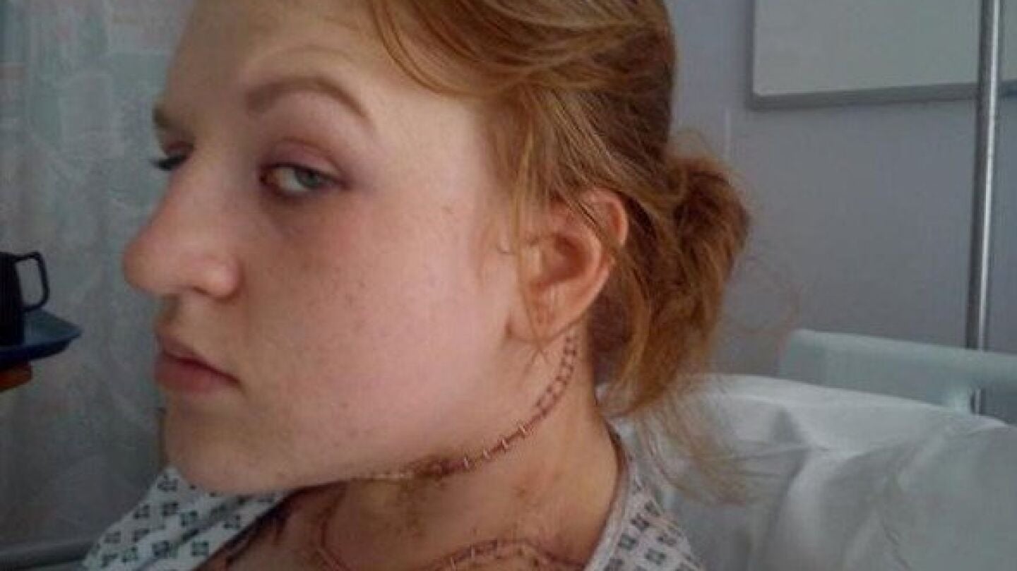 Cerys Head, tras ser operada de c&aacute;ncer de tiroides