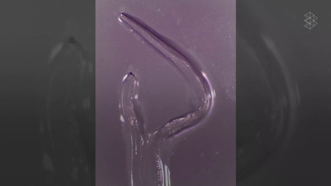 infección por gusanos oculares