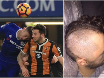 Ryan Mason tuvo que ser operado de la cabeza tras sufrir una fractura craneal Ryan Mason tuvo que ser operado de la cabeza tras sufrir una fractura craneal