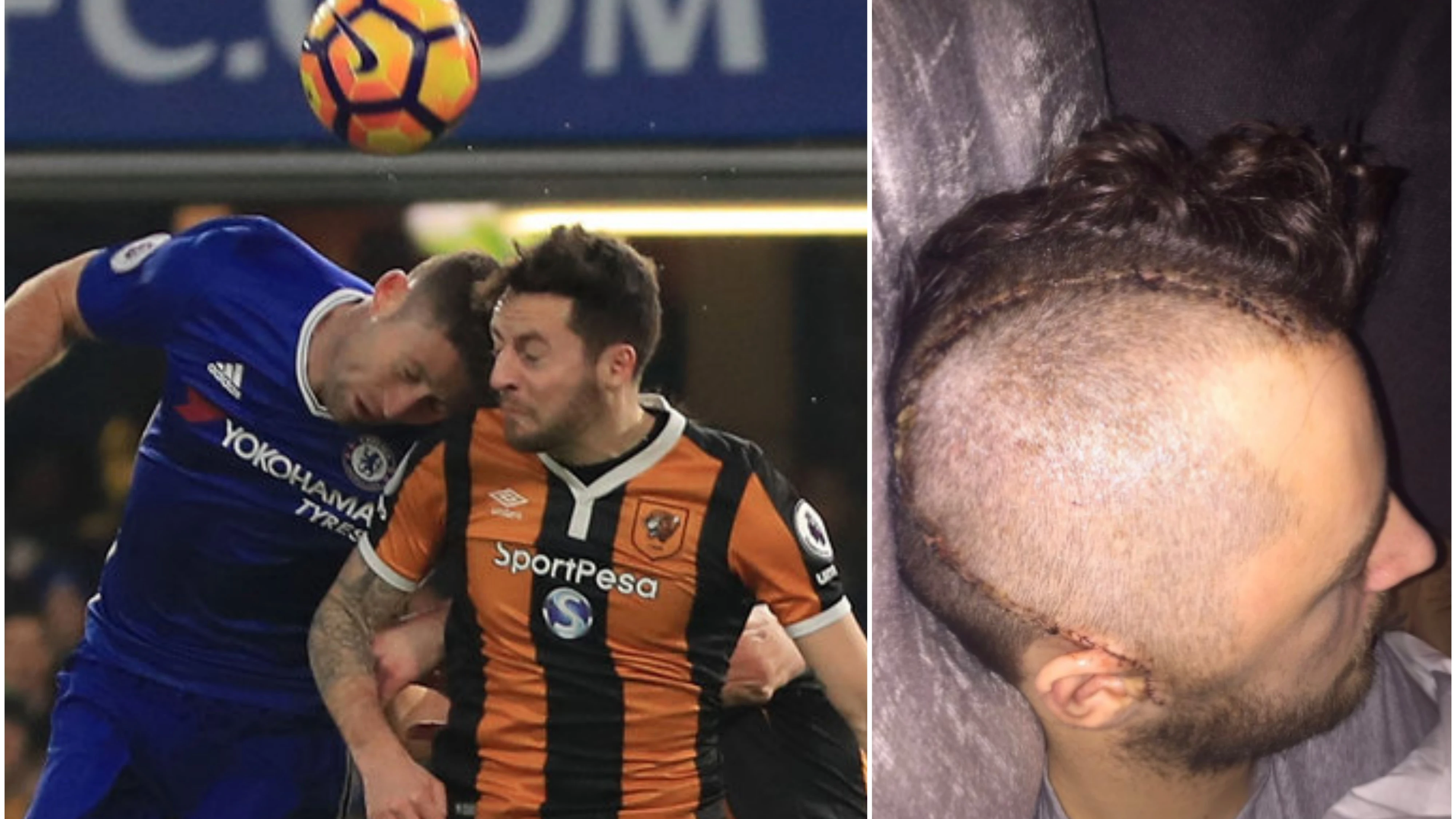 Ryan Mason tuvo que ser operado de la cabeza tras sufrir una fractura craneal