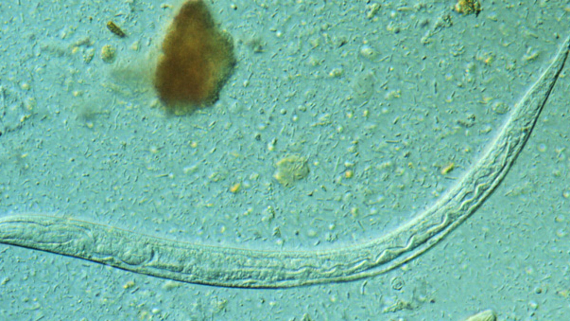 larva de Strongyloides stercoralis