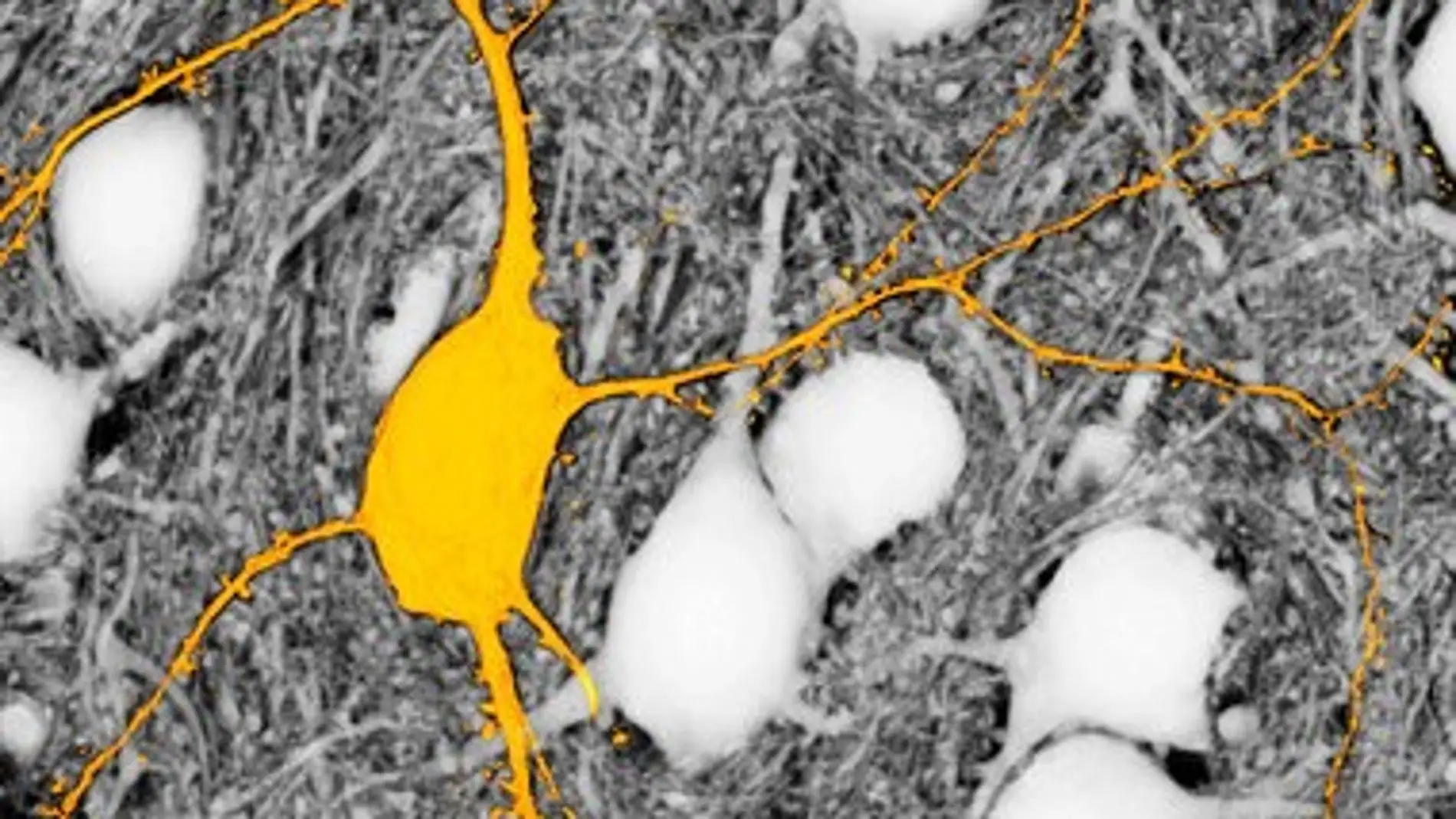 Neurona etiquetada en amarillo
