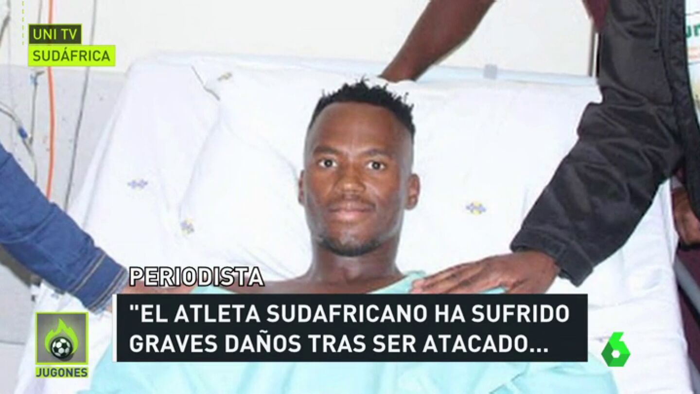Conmoci&oacute;n en Sud&aacute;frica tras cortarle las piernas a un triatleta con una sierra: "Un 80% de los huesos fueron seccionados"