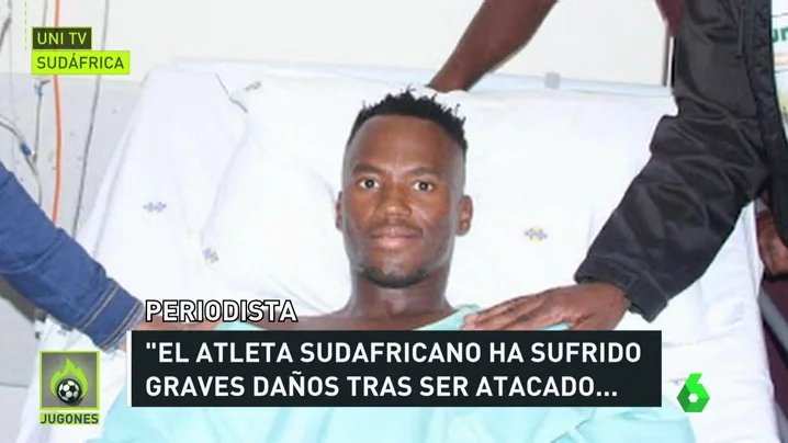 Conmoción en Sudáfrica tras cortarle las piernas a un triatleta con una sierra: "Un 80% de los huesos fueron seccionados"