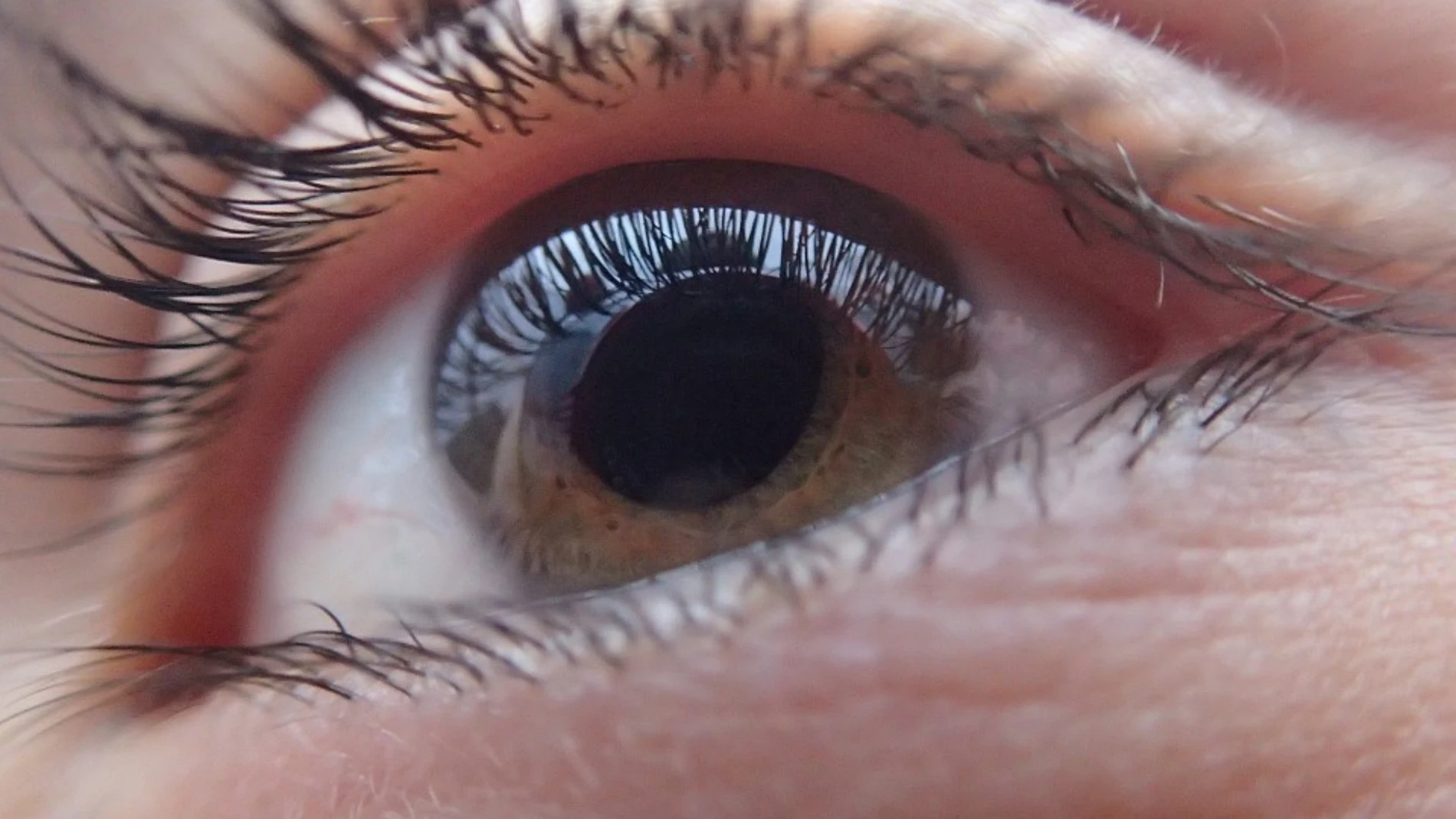 ¿Cómo funciona el implante que permite estimular la visión de las personas ciegas?