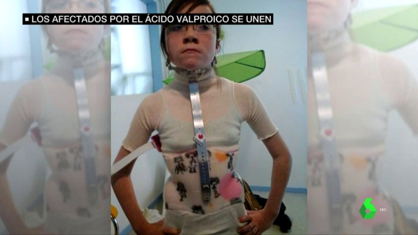 acido