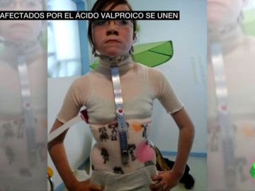 acido acido