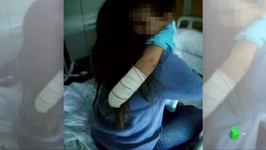 Un pitbull muerde a un niño de 19 meses que paseaba junto a su familia por Alpedrete, en Madrid Un pitbull muerde a un niño de 19 meses que paseaba junto a su familia por Alpedrete, en Madrid