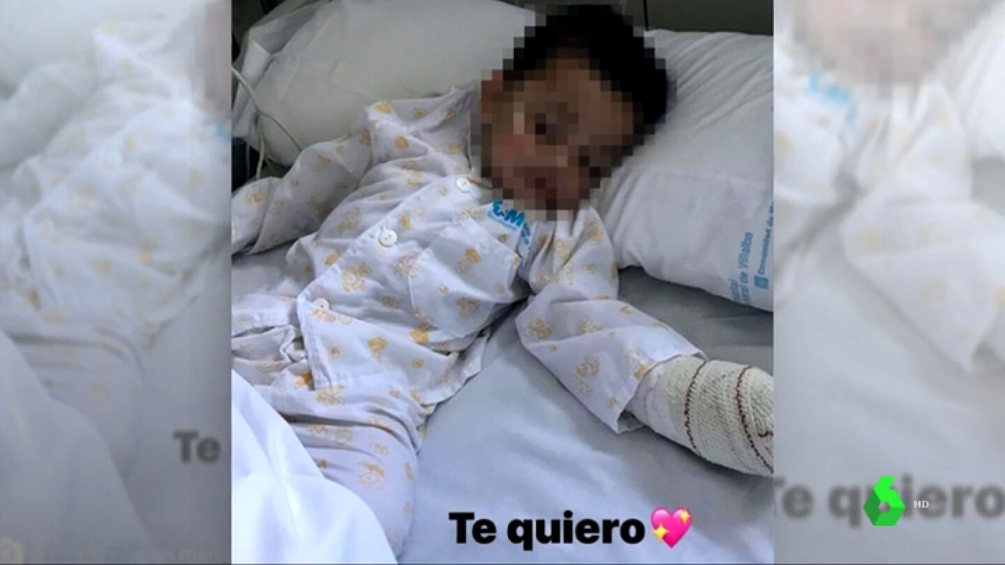 NI&Atilde;O ATACADO POR UN PITBULL