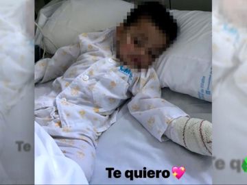 NIÃO ATACADO POR UN PITBULL NIÃO ATACADO POR UN PITBULL