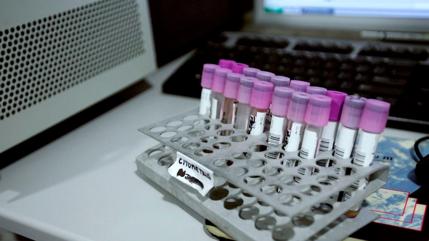 Tubos de an&aacute;lisis del laboratorio de pruebas cl&iacute;nicas