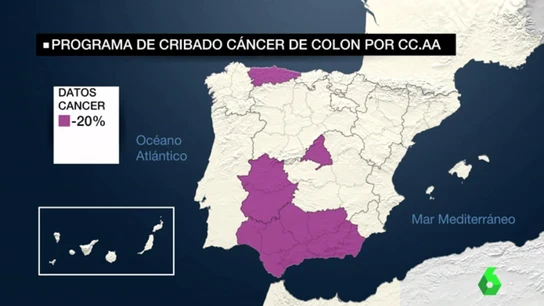 Programa de cribado de cáncer de colon por CCAA Programa de cribado de cáncer de colon por CCAA