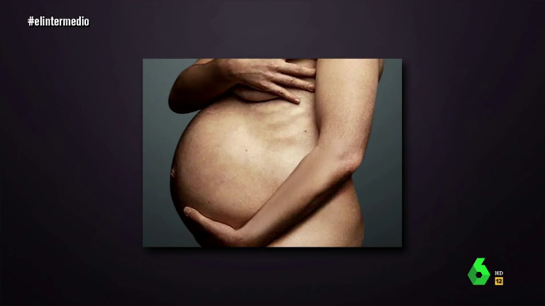 El "embarazo" de El Intermedio que "está en boca de todos los españoles": "Estoy de 13 semanas y son mellizos"