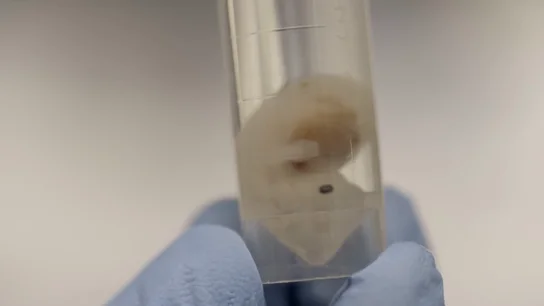 El futuro de los trasplantes, cultivar órganos humanos en embriones de animales: "El sueño es tener corazones o pulmones para trasplantar en el momento que queramos" El futuro de los trasplantes, cultivar órganos humanos en embriones de animales: "El sueño es tener corazones o pulmones para trasplantar en el momento que queramos"