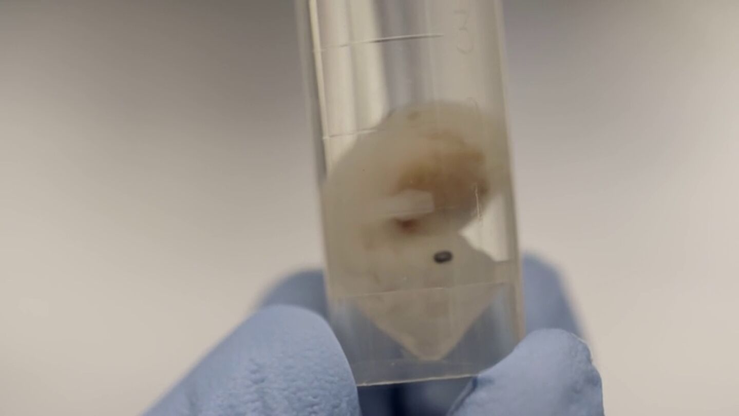 El futuro de los trasplantes, cultivar &oacute;rganos humanos en embriones de animales: "El sue&ntilde;o es tener corazones o pulmones para trasplantar en el momento que queramos"