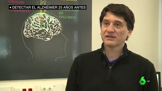 alzheimer alzheimer