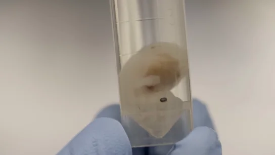 El futuro de los trasplantes en medicina: cultivar órganos humanos en embriones de animales El futuro de los trasplantes en medicina: cultivar órganos humanos en embriones de animales