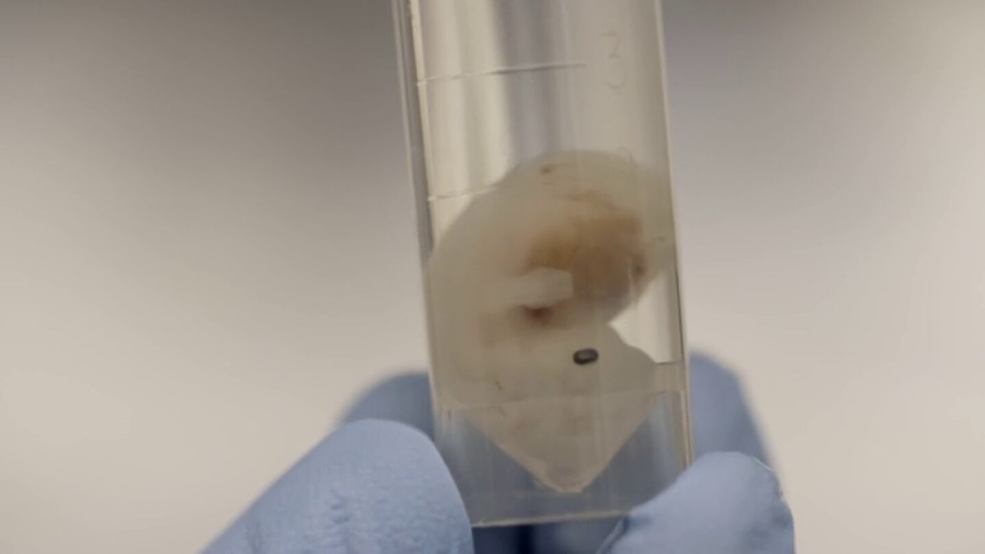 El futuro de los trasplantes en medicina: cultivar &oacute;rganos humanos en embriones de animales