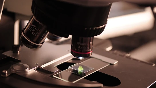 Científicos crean dispositivos cien veces más pequeños que una célula para detectar metástasis Científicos crean dispositivos cien veces más pequeños que una célula para detectar metástasis