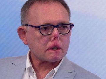 El doctor Jaco Nel El doctor Jaco Nel