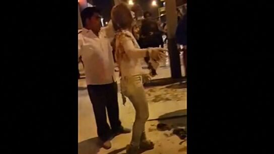 Mujer con quemaduras en el 60% de su cuerpo tras un ataque machista