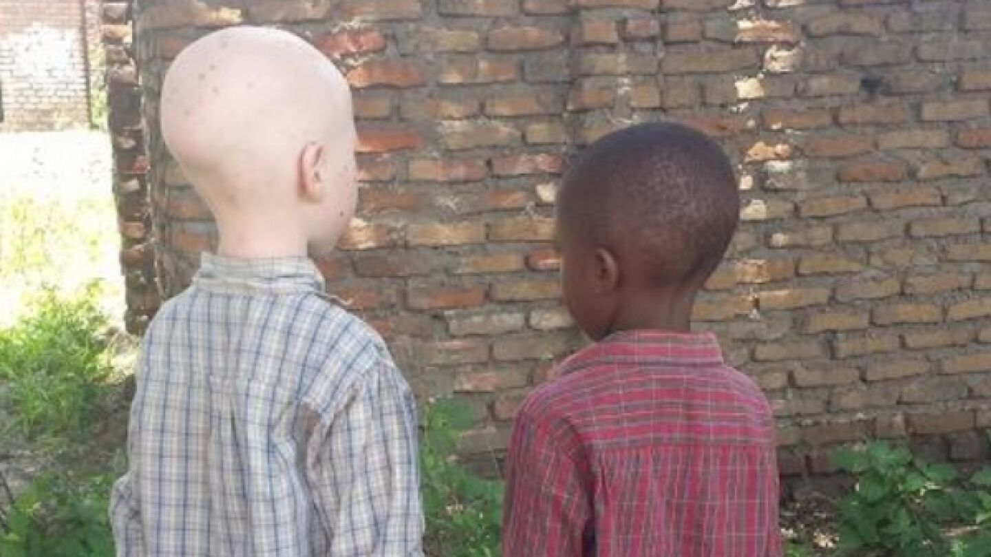 La 'caza' de los ni&ntilde;os albinos en &Aacute;frica
