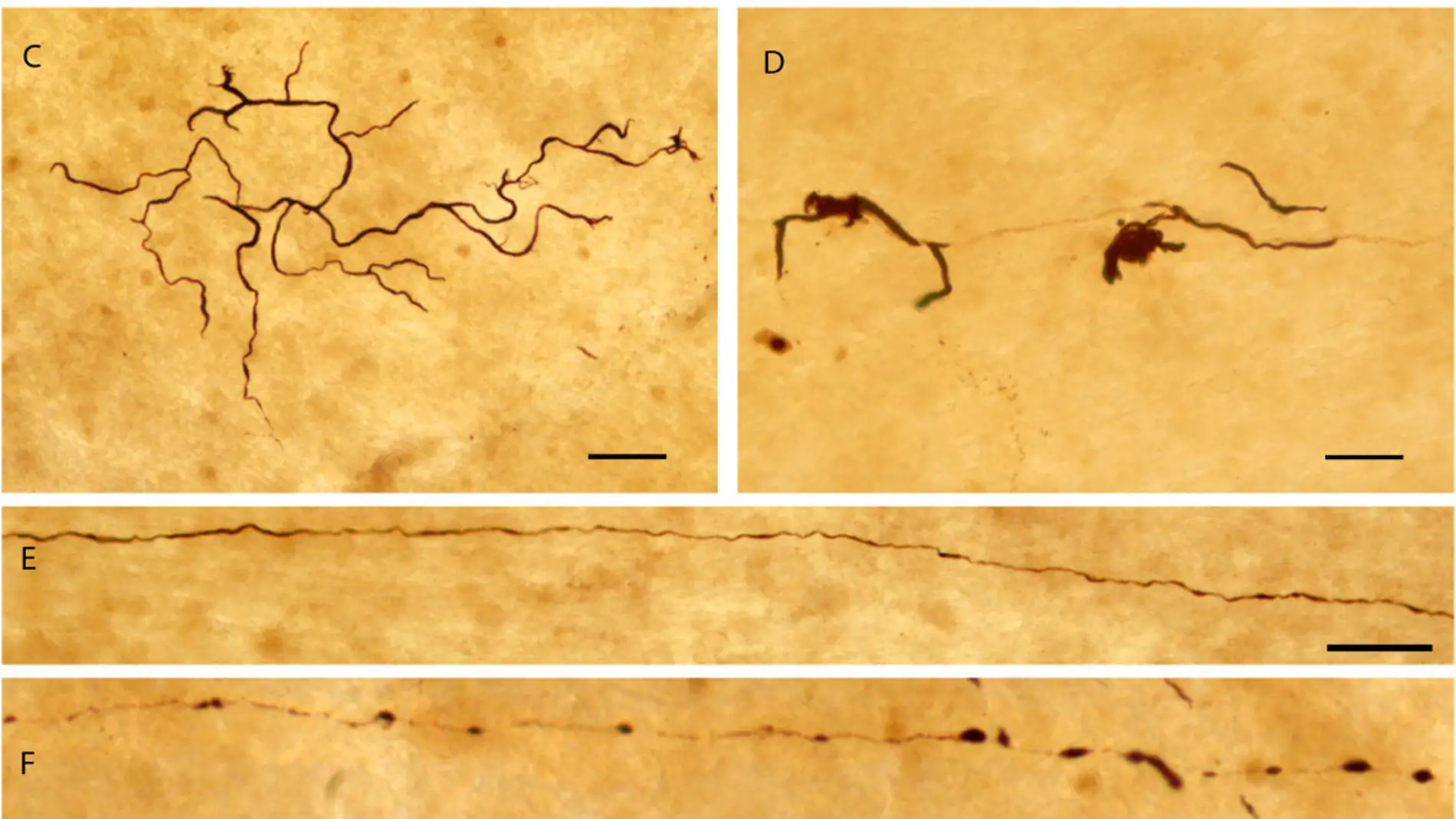 Figura estructuras inmunorreactivas en retinas