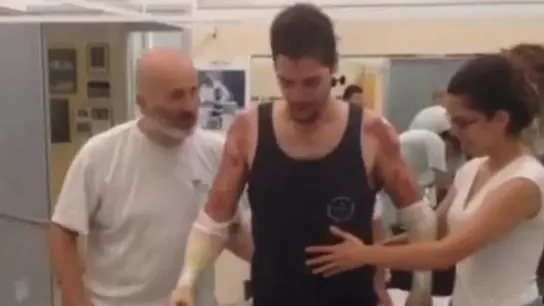 Los primeros pasos de Davide con sus prótesis nuevas Los primeros pasos de Davide con sus prótesis nuevas