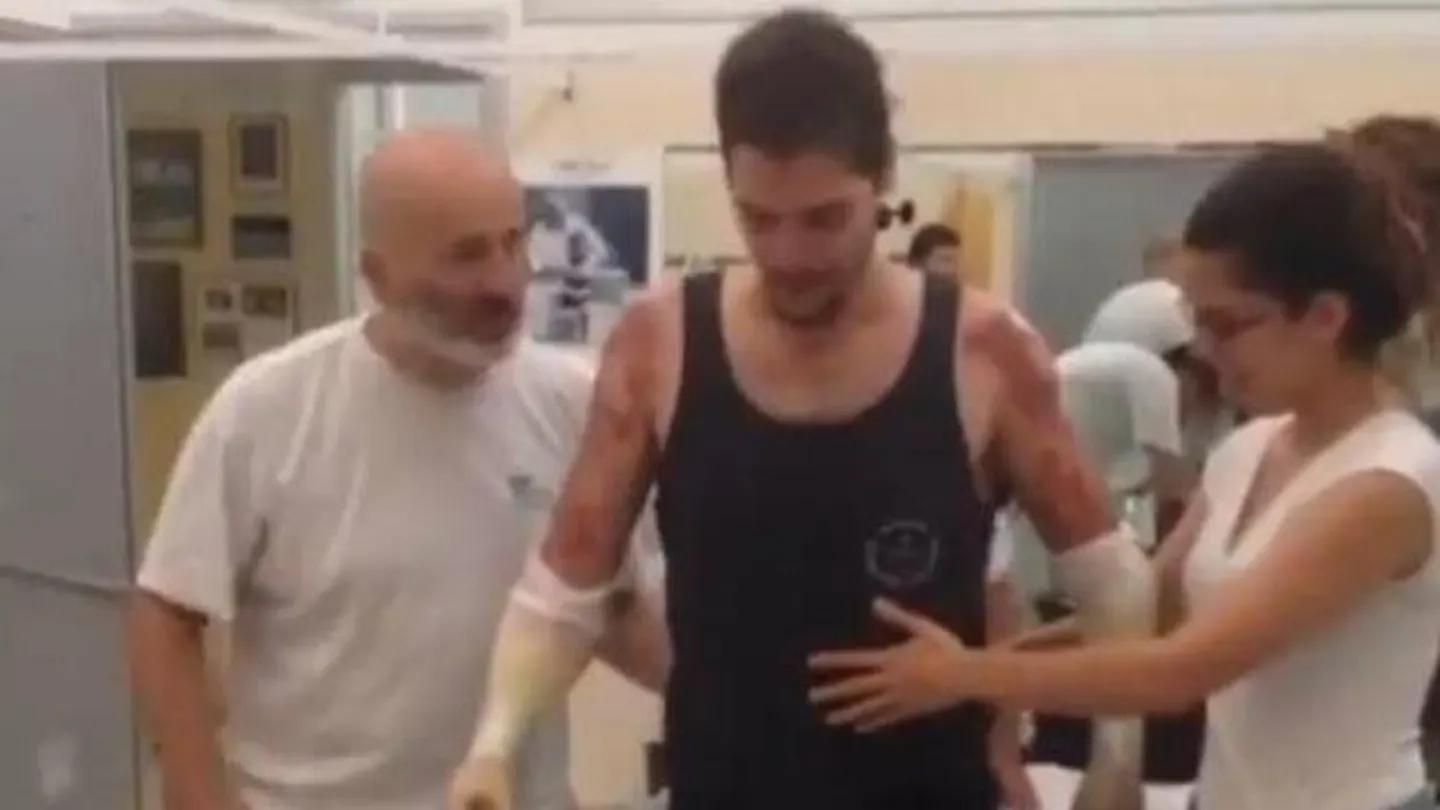 Los primeros pasos de Davide con sus prótesis nuevas Los primeros pasos de Davide con sus prótesis nuevas
